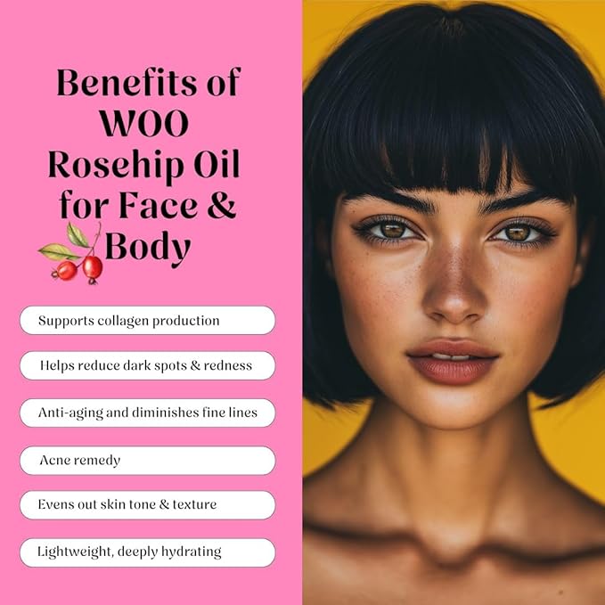 Certified Organic Rosehip Oil – 100% Pure, Cold-Pressed & Fair Trade | Face & Body Oil | Vitamin A, C & E Rich | Boosts Collagen, Fades Scars & Dark Spots, Soothes Acne | 3.4 oz
