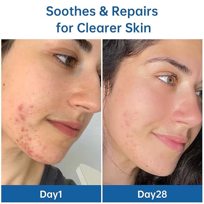 Anti Aging Peptide Serum for Face – Wrinkle Repair, Firming & Blemish Correcting Facial Serum, Hydrating Brightening Skin Barrier Care for Women/Men All Types