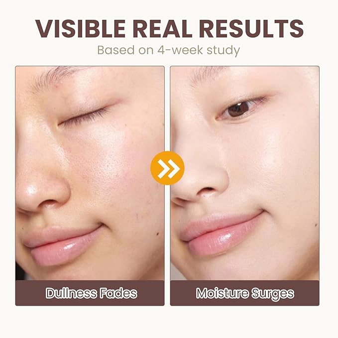 Rice Toner & Serum for Face, 70% Rice Water Facial Toner, Lightweight Hydrating Skin Care for Daily Use, Moisturizing Face Toner Suitable for All Skin Types, 120ml / 4.0 fl oz