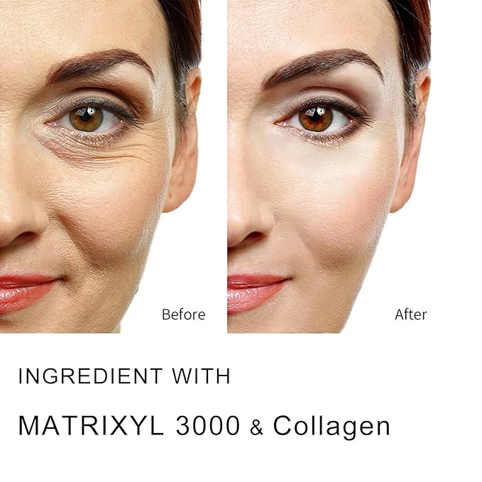 5% Collagen Serum, Anti Aging Serum for Women with Collagen and Matrixyl 3000 Skin Tightening, Helps Lift, Plump, & Firm Sagging Skin for Face 1 Fl Oz