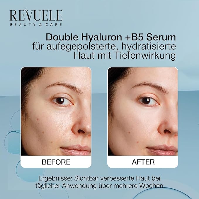 REVUELE Double Hyaluron + B5 Serum, Hydrating Face Serum with Hyaluronic Acid & Panthenol 1 fl.oz