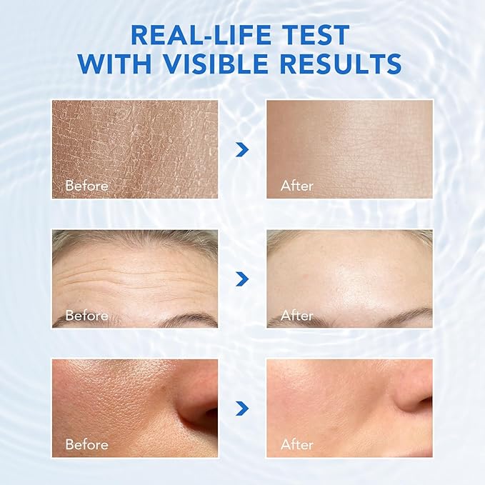 3% Hyaluronic Acid Serum Ultra-Hydrating Vials,Hyaluronic Acid, Hyaluronic Acids for Face Serum for Women Anti Aging Single-Use Tubes Vials(1 Box of 30)