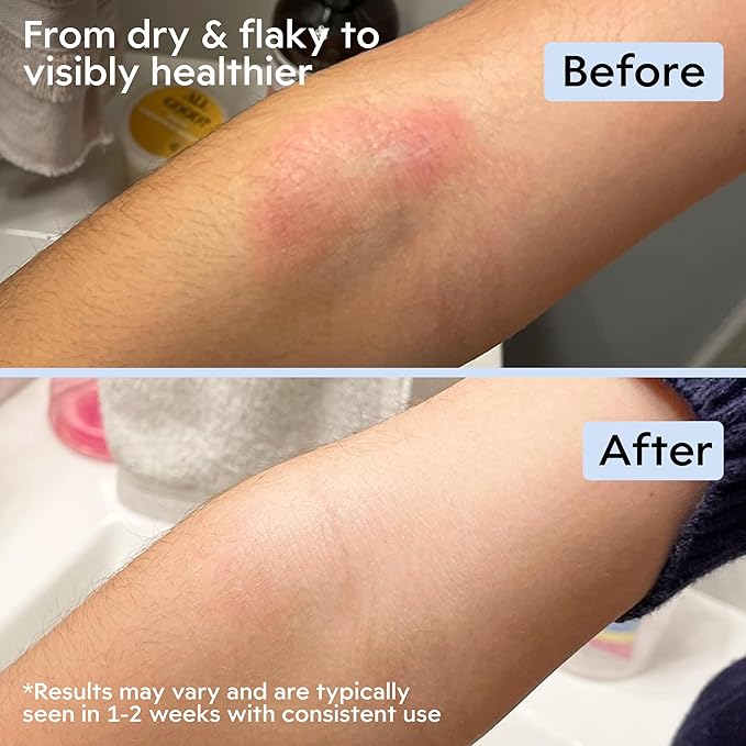 Clearbody Organics Manuka Honey Cream for Eczema & Dry Skin - Manuka Honey Ointment - Colloidal Oatmeal, Aloe & Natural Ingredients - Fast Relief Lotion for Reactive Skin - No Greasy Residue - 1 oz