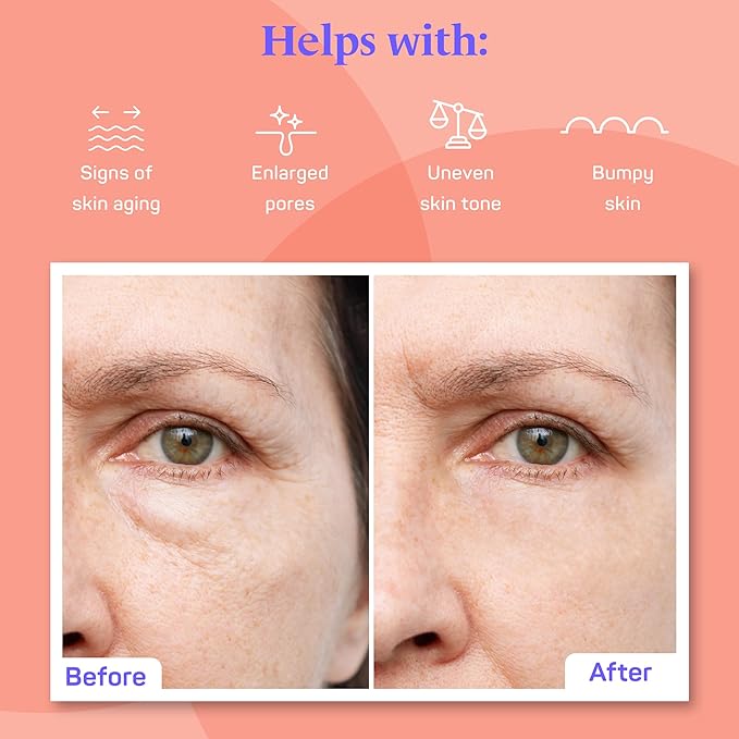 Pure Retinol Creamy Serum LARGE 2oz with Hyaluronic Acid and Vitamin E | Pure Retinol Serum For Face - Unmatched G3L Delivery System - Moisturizer | Made in USA - 2 fl oz/59.4 ml