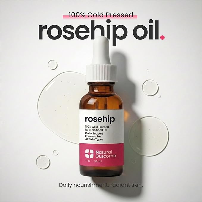 natural outcome Rosehip Oil 100% Pure Cold-Pressed Rosehip Seed Face Oil - Anti-Aging Facial Oil to Plump, Balance & Hydrate 1 oz