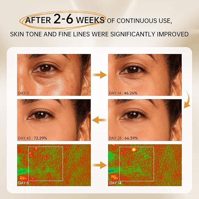 Bakuchiol Retinol Serum, 1% Retinol for Anti-Aging and Anti-Wrinkle, Gentle Yet Potent Formula for Sensitive Skin.