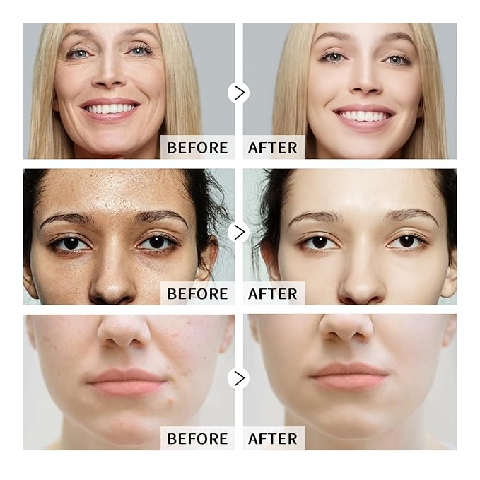 Hyaluronic Acid Serum & Niacinamide Serum Set 2PCS - Reduces Wrinkles, Smooths Fine Lines, Improves Skin Texture - Facial Serums Moisturizing, Oil-Regulating, Pore-Minimizing for All Skin Types