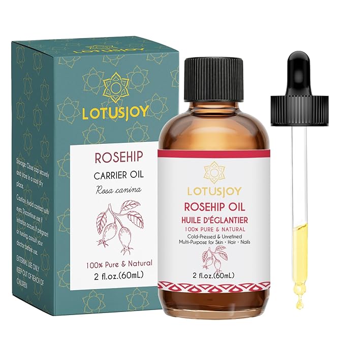 Rosehip Oil, 100% Pure & Natural Carrier Oil, Cold-Pressed & Unrefined, Multi-Purpose for Skin Hair Nails, 2 fl.oz (60mL)