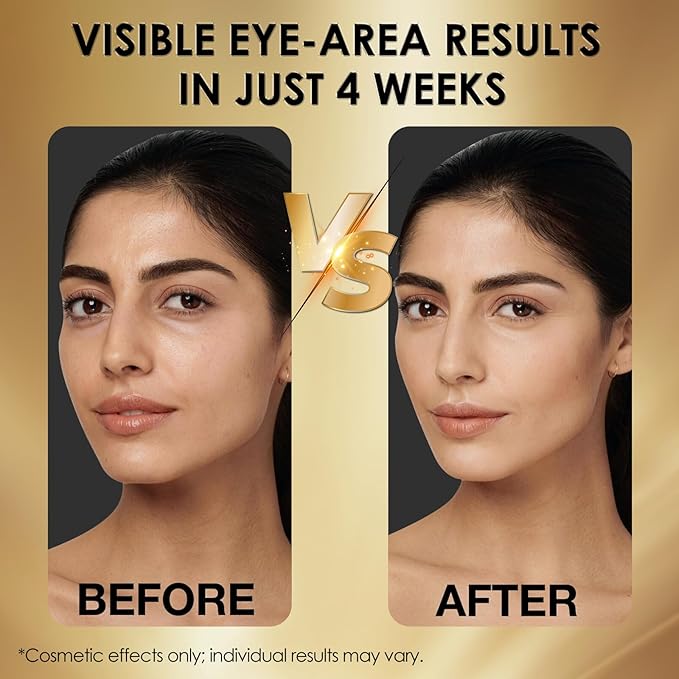 Eye Serum for Dark Circles and Puffiness - Advanced Anti-Aging Under Eye Treatment for Wrinkles, Bags and Fine Lines - Hydrating and Firming Formula to Brighten and Revitalize Tired Eyes