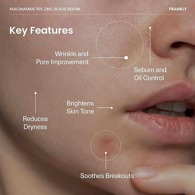 FRANKLY Niacinamide 15% + Zinc Bead Serum | High Dose Yet Gentle Skin Repair | Acne, Pore & Redness Control | Bead-to-Skin Delivery System for Fresh Niacinamide | Vegan Korean Skincare | 1.01 fl.oz