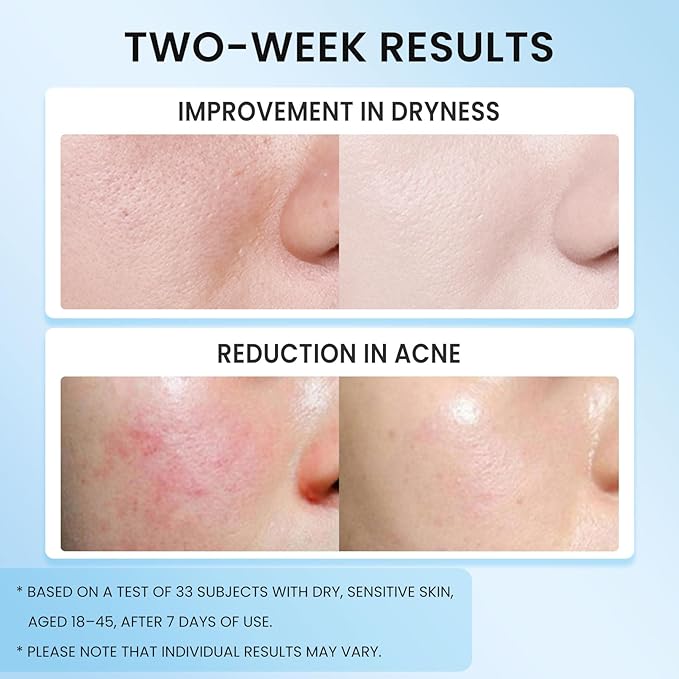 5X Ceramide Barrier Moisturizer Face Cream, With Ceramide Hyaluronic Acid Centella Collagen Hydration Relief Redness Reducing Ultra Repair Cream For All Skin Type Sensitive Skin 2PCS