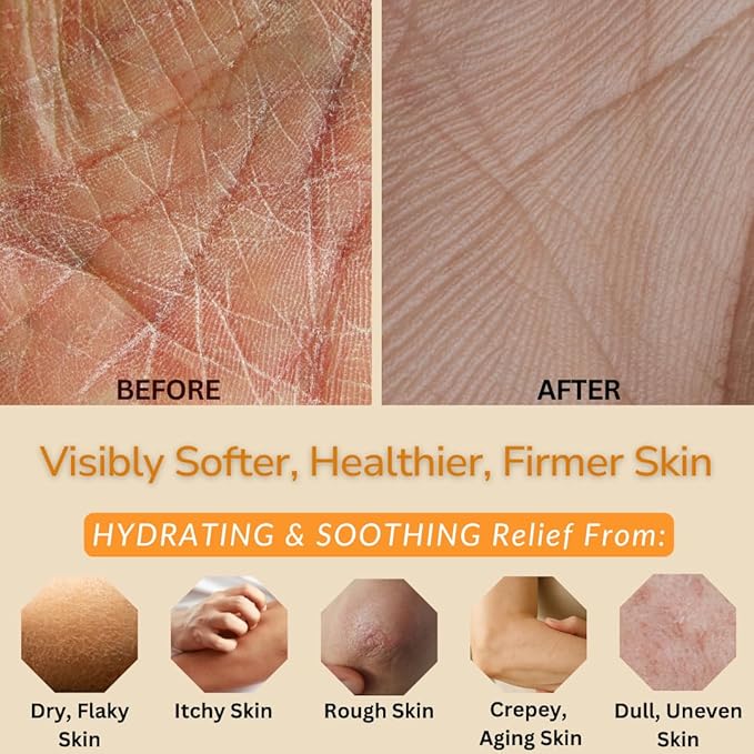 Natural Escapes Orange Vanilla Body Lotion for Dry Skin, Ceramide Hand & Body Moisturizer with Coconut Oil, Vitamin B5 & E, Hydrating Lotion, 8 Oz
