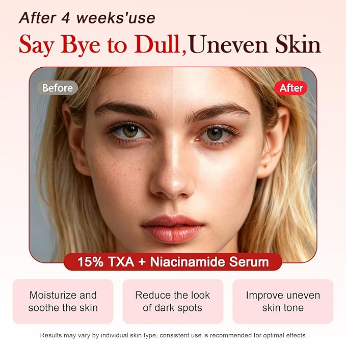 TXA 5% + Niacinamide 10% Facial Serum for Dark Spot, Uneven Skin Tone & Daily Hydration Care, Glow Serum for Face, Tranexamic Acid 5% | Korean Skincare, 1.01 fl.oz