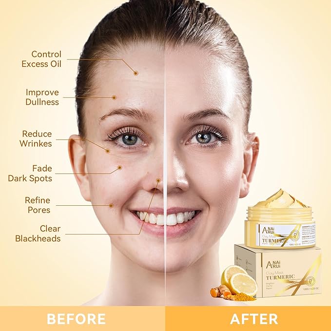 Turmeric Vitamin C Face Mask, Deeep Cleansing Clay Mask for Dull Skin, Skincare Facial Mask for Refining Pores and Controlling Oil, Smooth & Radiant Skin, Face Skincare Gifts, 4.23 OZ