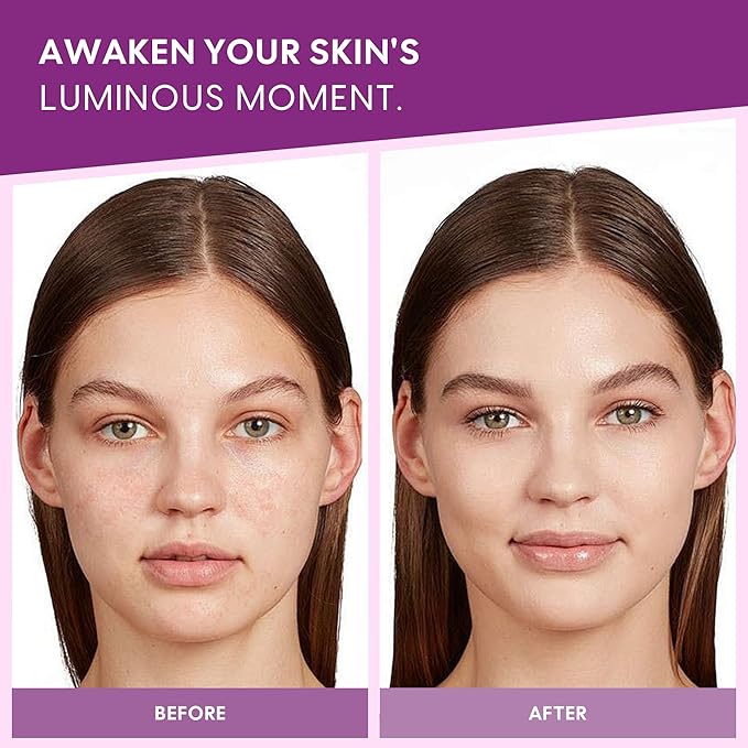 Niacinamide 20 Serum with Hyaluronic Acid, Glutathione & Tranexamic Acid - Concentrated Serum for Face, Uneven Skin Tone, Pore Care for Sensitive Skin