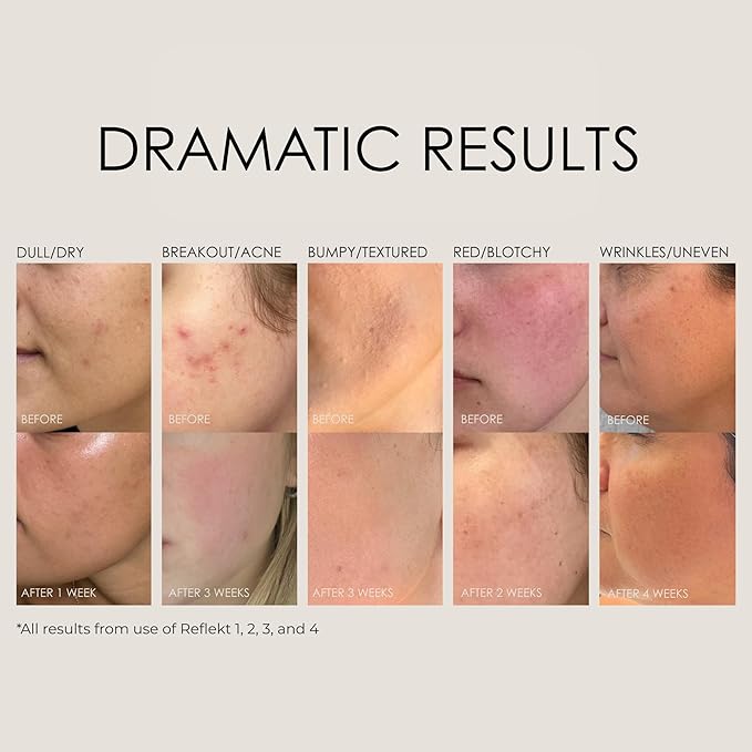 REFLEKT 2 – Vitamin C Brightening Anti-Aging Serum – Collagen-Boosting with Peptides & Hyaluronic Acid, Radiance & Elasticity Enhancer, Clean, Vegan, Cruelty-Free, Fragrance & Paraben-Free Formula
