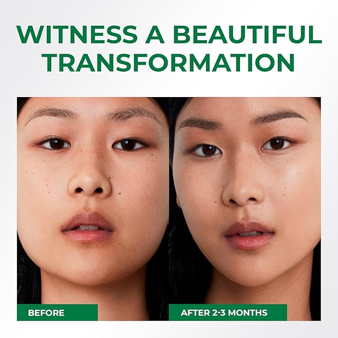 Rice Toner for Face, 82% Rice Extract with Hyalyronic Acid, Niacinamide and Centella Extract - Hydrating for Dry, Dull, Combination Skin, Vegan, Fragrance Free, Glass Skin