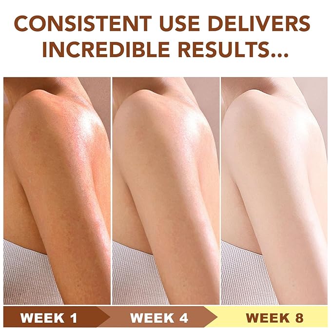Unrefined Shea Butter Raw Organic for Skin and Hair, Pure and Natural Raw Shea Butter Moisturizer for Dry Skin Care 1Pack
