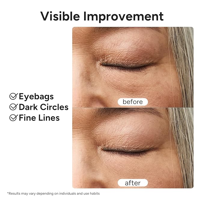 In My Eyes Eye Repair Gel Cream - Under Eye Cream with Caffeine & Lutein, Anti-Wrinkle and Firming, Treatment to Reduce Dark Circles, Fine Lines & Puffiness, 0.5 oz.