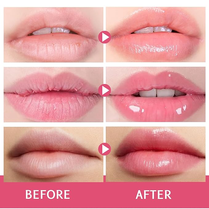 24H Lip Mask Set – Strawberry Day & Coconut Night Care – Hydrating & Softening Lip Sleeping Mask Duo for Dry, Flaky Lips – 10g x 2 (Strawberry and Coconut Set)