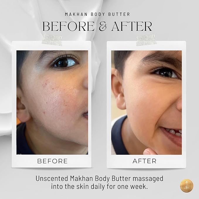 Organic Mahkan Whipped Body Butter 8 oz Jar | Airy & Nourishing Formula | Unscented | Non-Greasy, Deeply Hydrating, Organic & Natural Ingredients (8 oz, Unscented)