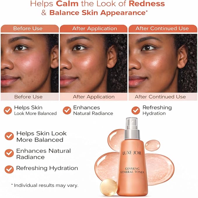Witch Hazel Toner Mist with Ginseng – Hydrating Facial Toner Spray for Sensitive Skin – Pore Refining Botanical Face Toner for Oily, Dry & Combination Skin – Alcohol Free – 8 oz