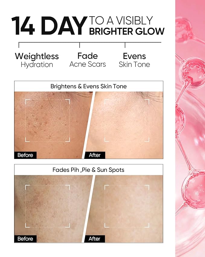 Niacinamide Brightening Cream,Fades Dark Spots, Evens Skin Tone, Tranexamic Acid, α-Arbutin, 5X Ceramides, Centella Asiatica, Suitable for Oil and Acne-prone skin, 2.82 OZ / 80g