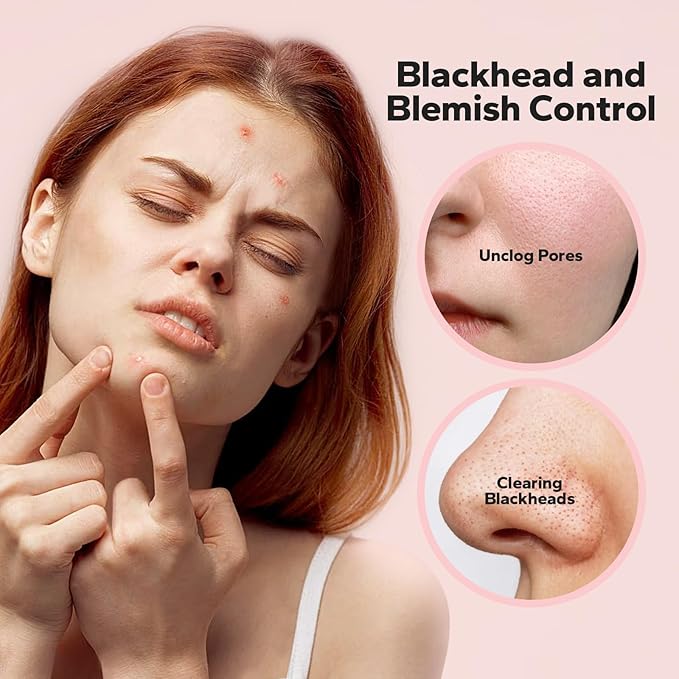 SilkyShark Niacinamide Serum (1 Fl Oz), 10% Niacinamide + 4% Tranexamic Acid Serum, Face Serums for Pore Minimizing, Dark Spots, Blackhead Removal, Hydrating, and Anti-Aging