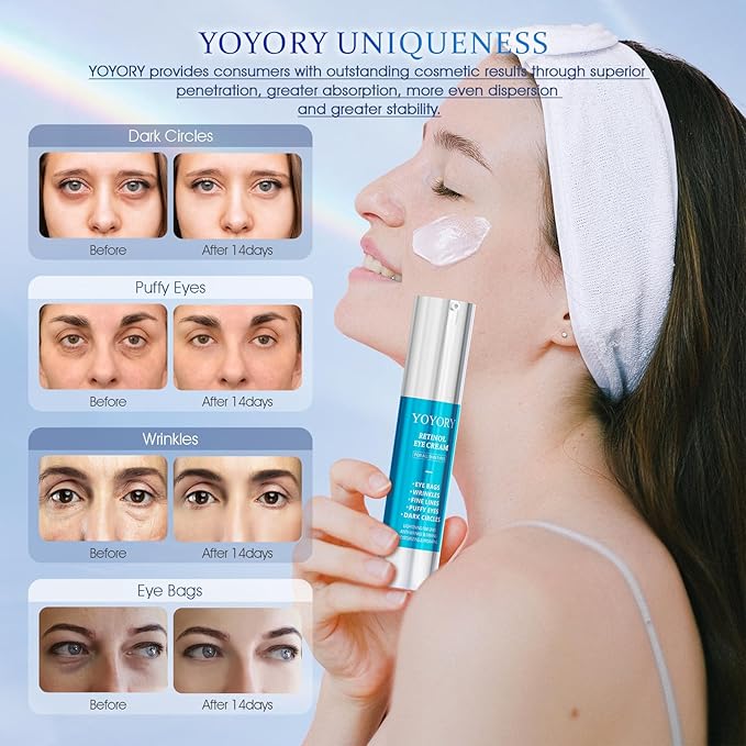 Retinol Eye Cream for Eye Bags - Anti-Aging Under Eye Treatment for Dark Circles, Fine Lines,Wrinkles, Puffiness Hydrating & Moisturizing Skin Care for Women and Men, 0.67 fl oz
