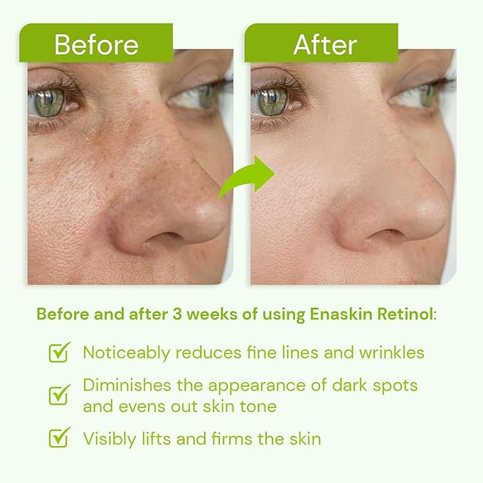 Retinol Serum for Face, Anti-Aging for Fine Lines, Wrinkles & Dull Skin, Hydrating & Gentle Formula with Peptides, Hyaluronic Acid & Niacinamide, Beginner-Friendly Night Skincare for Women, 1.0 fl.oz