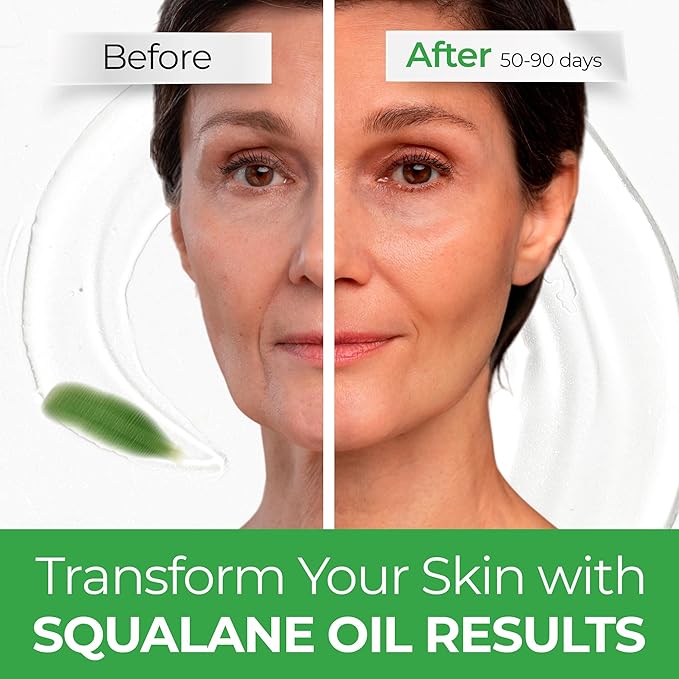 Squalane Oil for Face - 100% Pure Organic Squalane Moisturizer - Plant Natural Facial Oil - Nourishment Hydrating Face Oil - Vegan - Non-comedogenic
