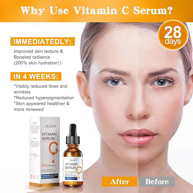 Organic Vitamin C Serum for Face 31% Vitamin C Facial Serum Anti Aging Serum Reduces Age Spots, Face Dark Spots, Sun Damage, Skin Brightening Facial Serums with Hyaluronic Acid and Astaxanthin