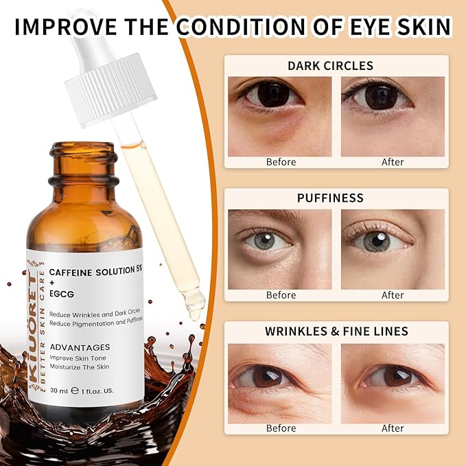 Caffeine Solution 5% + EGCG - Caffeine Eye Serum for Dark Circles Reduces Pigmentation and Puffiness - Caffeine Solution 5% for Wrinkles and Fine Lines for All Skin Types