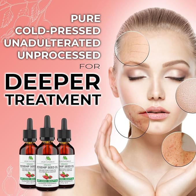 Jeune Naturelle Rosehip Oil - Pure, Virgin, Cold Pressed - From Whole Berries (Pulp & Seeds), Natural Deep Orange Hue for Intensive Skin Repair - Undiluted Organic Rosehip Seed Oil, 2 oz
