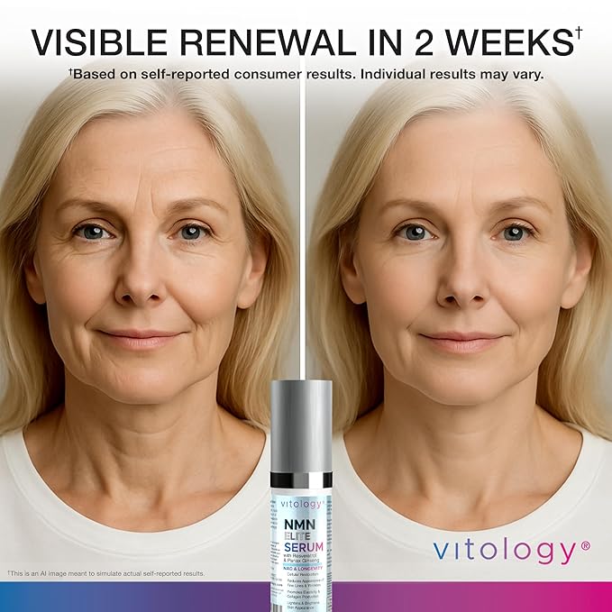 NMN + Resveratrol Face Serum – Cellular Renewal & Anti-Aging Formula with Hyaluronic Acid, Aloe & Ginseng – Boost NAD⁺, Hydrate, Firm & Revitalize Skin for Youthful Radiance – 1.7 fl oz
