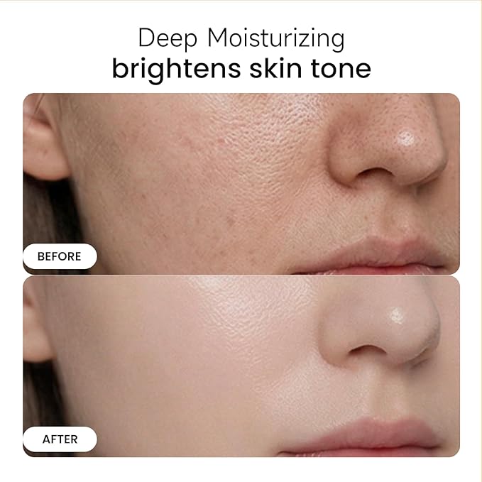 Skin Care Essential oil Coconut & SqualaneDual-Essence Oil Skincare Tech 2026 | 80ml Soothes,Brightens, and repairs your skin barrier. Formulated for allskin types