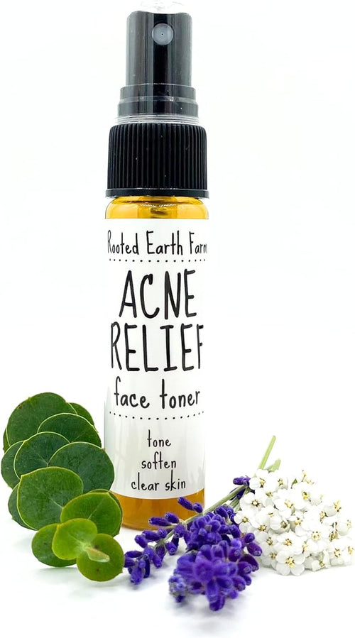 Acne Relief Face Toner - 1 fl oz - Facial Toning Spray - Herbal