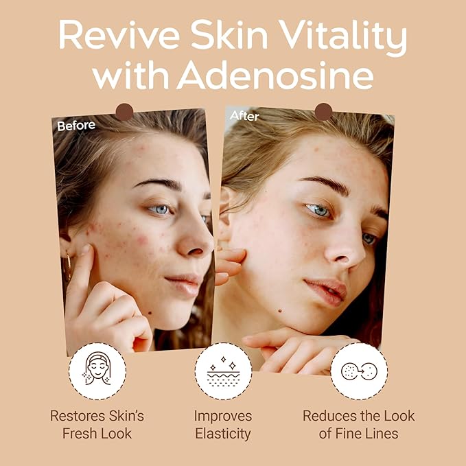 Tree To Tub Tranexamic Acid Serum for All Skin Types - Reduce the Look of Dark Spots w/Alpha-Arbutin, Hyaluronic Acid, & Vitamin C - Hydrating, Vegan Formula for Radiant, Even-Looking Skin