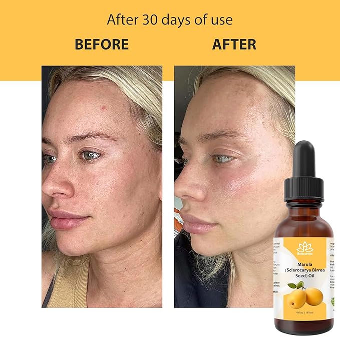 Relaxcation Marula Oil – Cold Pressed Organic Oil from Sclerocarya Birrea Seeds | Pure Extract for Hair, Face, Nail & Body | Unrefined, Vegan, Hydrating, Travel Size Glass Bottle (1 oz)