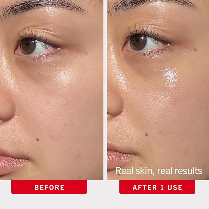 First Aid Beauty - Hydrating Eye Cream with Hyaluronic Acid, Nourishing Eye Cream that Provides 24 hours of Hydration, Helps Smooth Fine Lines, Wrinkles & Puffiness, Safe for Sensitive Skin, 0.5 oz