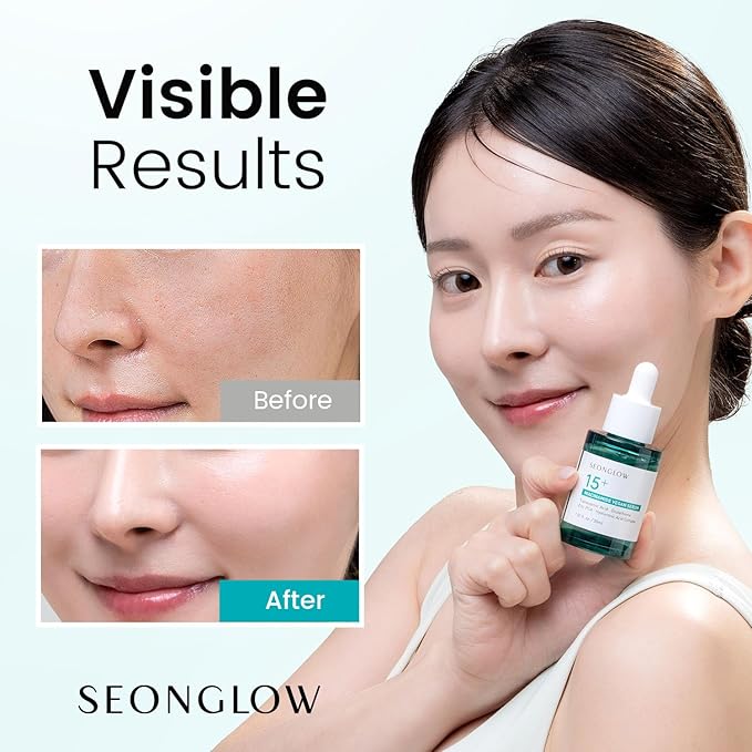 15% Vegan Niacinamide+ 3% Tranexamic Acid Serum: Korean Skin Care Niacinamide serum - Pore Minimizer for Face, Glutathione, Zinc PCA, 1.01 fl.oz.(30ml)
