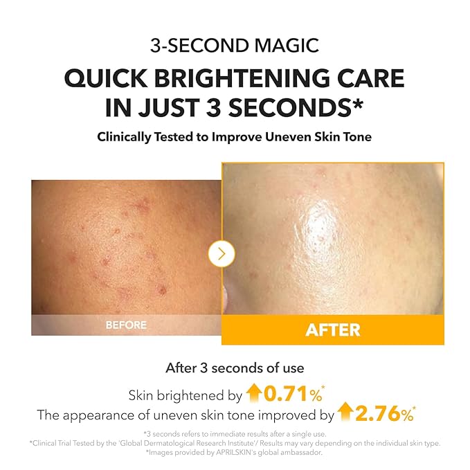 APRILSKIN A.C.E Serum｜Vita Kojic Serum for Brightening & Glow｜3-Second Brightening｜Kojic Acid & Vitamin C for Uneven Skin Tone｜Korean Skin Care｜3.88 oz.