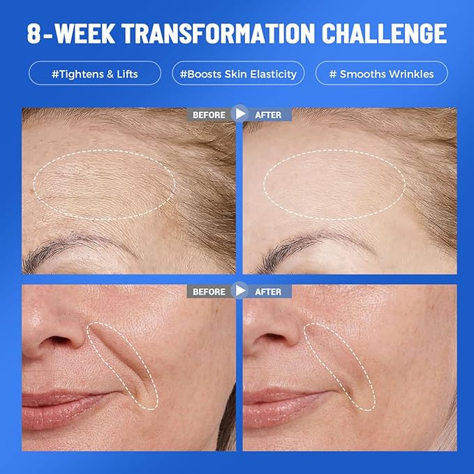 Okela 7 Pack Collagen Hydrogel Face Mask Overnight- Deep Hydrating & Lifting Facial Mask for Firming, Brightening & Moisturizing, Revitalizing Skincare Treatment Gift for Women