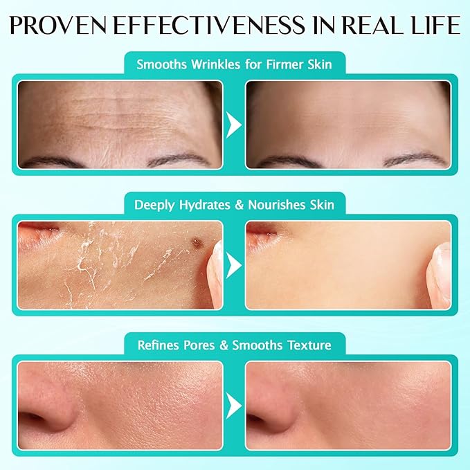 Meifenla 3% Hyaluronic Acid Serum for Face,Ultra-Hydrating Hyaluronic Acid Serum Tube Smooth Skin Deep Moisturizing Facial Serum for Anti-Aging with 30 Pcs Single-Use Vials Design