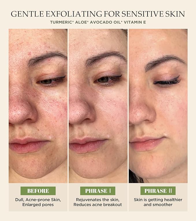 Revitalizing Exfoliation Face Scrub with Vitamin C and Turmeric – Gentle Exfoliating Face Wash for Blackheads, Pore Dirt & Dark Spots –Daily Balancing Facial Scrub for All Skin Types, 4.23 Fl Oz