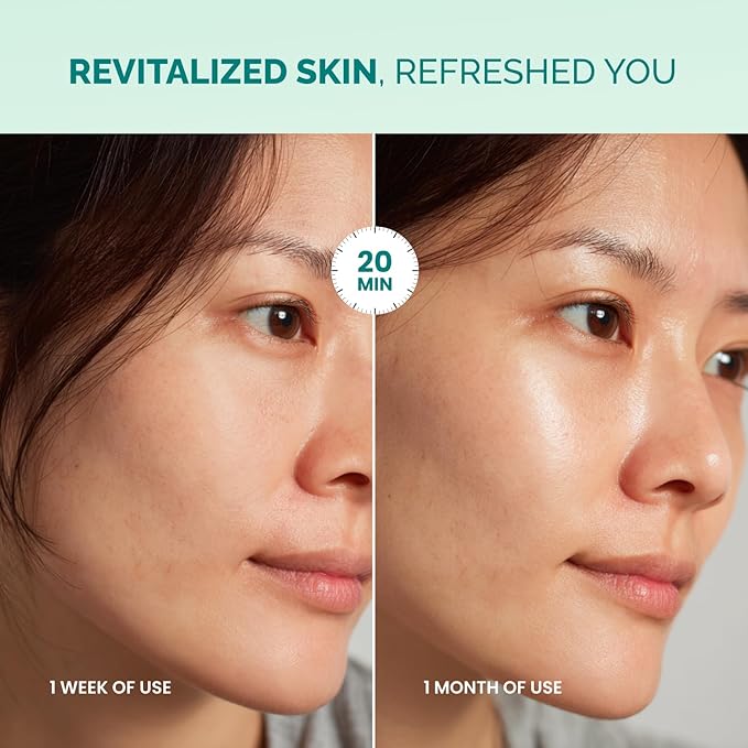 PLANTIFIQUE Korean Sheet Mask, 5 Pack - Hydrating & Nourishing Face Masks with Aloe Vera, Ceramide NP and Hyaluronic Acid - Mascarillas Faciales
