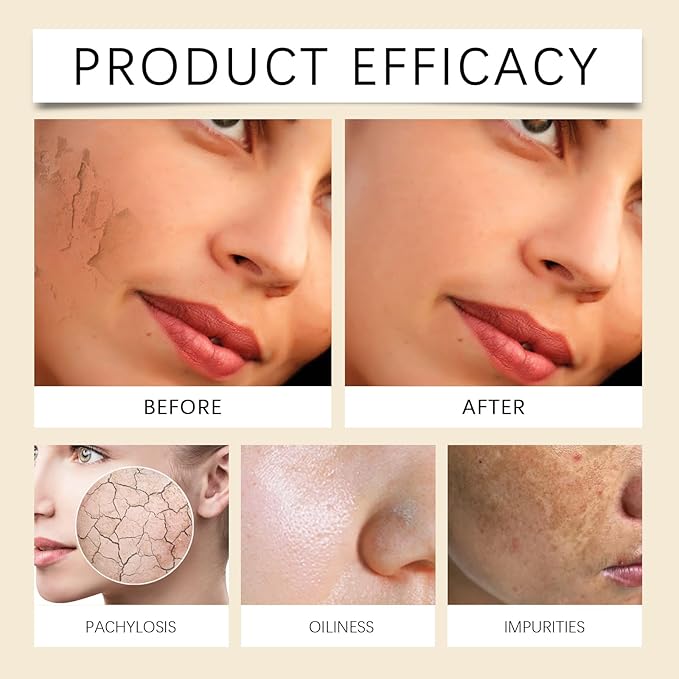 Turmeric Vitamin C Clay Mask, Suitable for Dark Spots and Dull Skin, Deep-Cleaning and Moisturizing Skincare Mask That Can Remove Blackheads and Pores, and Improve Uneven Skin Tone, 4.23 Ounces