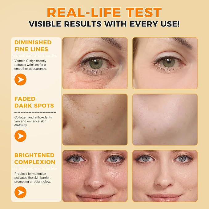 Vitamin C Serum, Pure 12% Super Vit C Serum Vitamin E & Ferulic Acid for Improving Appearance-Dark Spots, Face Moisturizer-Renewing Skin Care,2.02Fl Oz