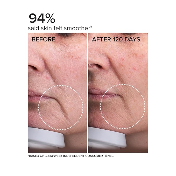 DRMTLGY Needle-less Serum – Peptide & Ceramide Face Serum for Fine Lines & Wrinkles, Hydrating & Firming Anti Aging Serum with Niacinamide & Hyaluronic Acid, Smooths & Plumps Skin, 1 oz