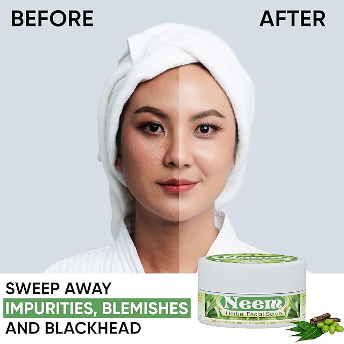 Herboganic Neem Facial Scrub - Natural and Gentle Face Scrub for Deep Cleansing and Moisturizing - Vegan Skincare - 5.30 oz…